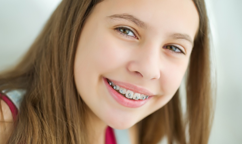 Niềng răng giá bao nhiêu còn tùy thuộc vào tình trạng răng miệng của mỗi người