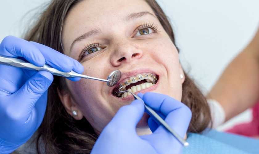 Giá niềng răng tại các nha khoa có sự chênh lệch nhất định