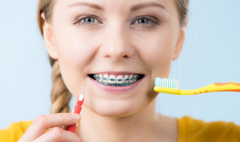 Quá trình chăm sóc răng miệng ảnh hưởng lớn đến kết quả niềng răng