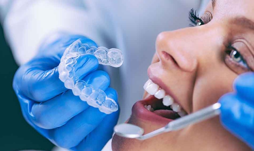 Niềng răng Invisalign là gì? Có ưu điểm gì không?