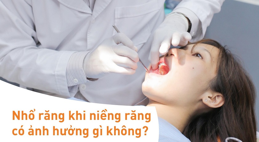 Nhổ răng khi niềng răng có ảnh hưởng gì không?