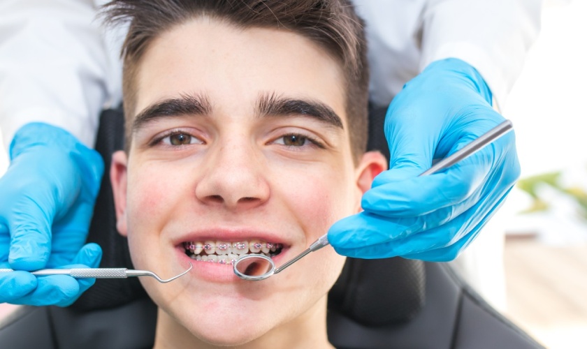 Niềng răng thẩm mỹ và những điều cần biết