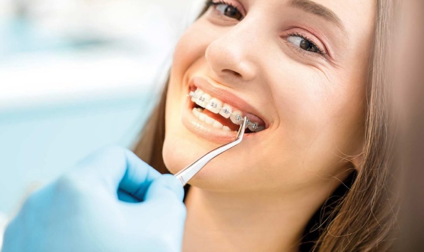 Mắc cài kim loại có giá thành hợp lý