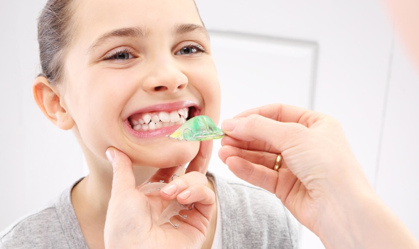 Niềng răng tháo lắp dành cho trẻ em