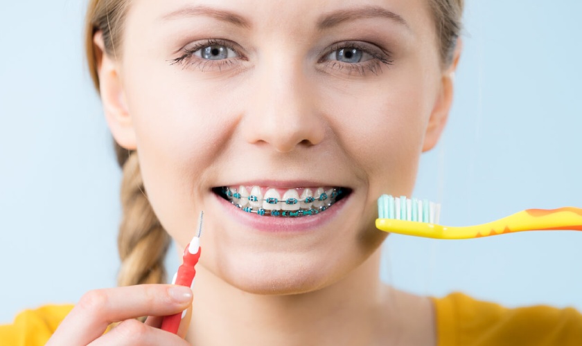 Cách chăm sóc tại nhà ảnh hưởng rất nhiều đến thời gian niềng răng