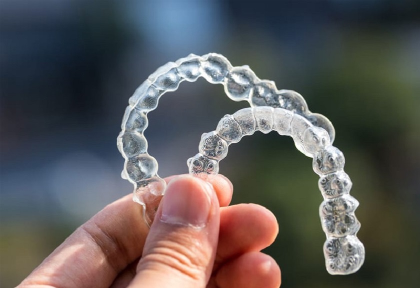 Số khay niềng cần đeo phụ thuộc vào mức độ sai lệch răng