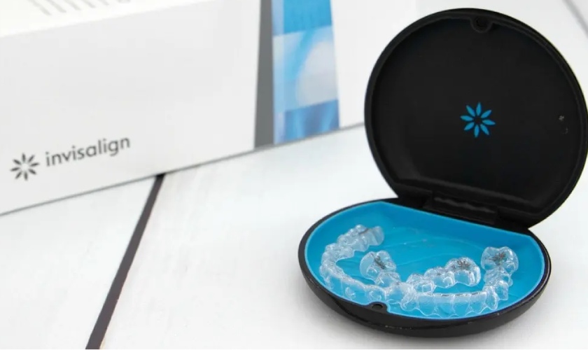 Niềng răng Invisalign là phương pháp chỉnh nha hiện đại