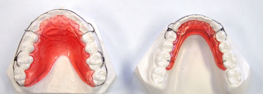 Khí cụ chỉnh nha luôn được kiểm định nguồn gốc