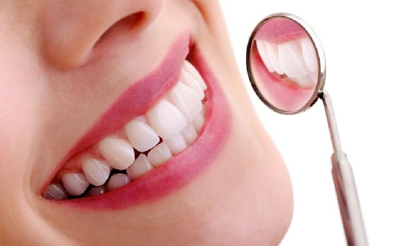 Bọc răng sứ giúp răng đều đẹp nhanh chóng