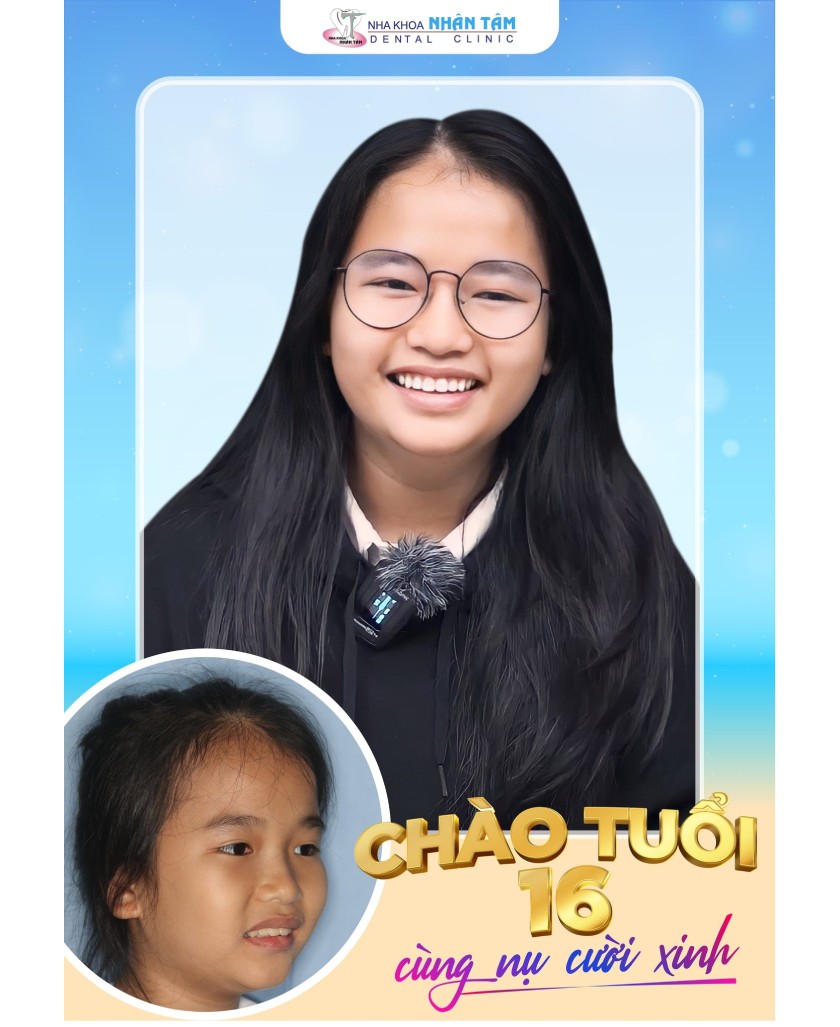 Khách hàng niềng răng tại Nha khoa Nhân Tâm