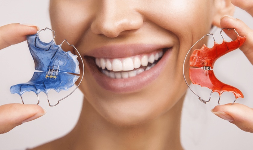 Sau khi niềng nếu không đeo hàm duy trì đúng cách sẽ khiến răng dễ bị chạy về vị trí cũ