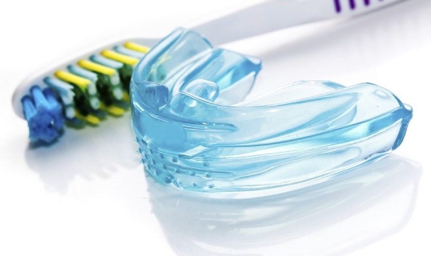 Niềng răng silicon