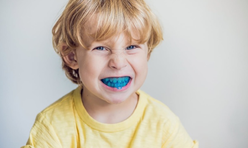 Hàm silicon giúp định hình hàm răng của trẻ
