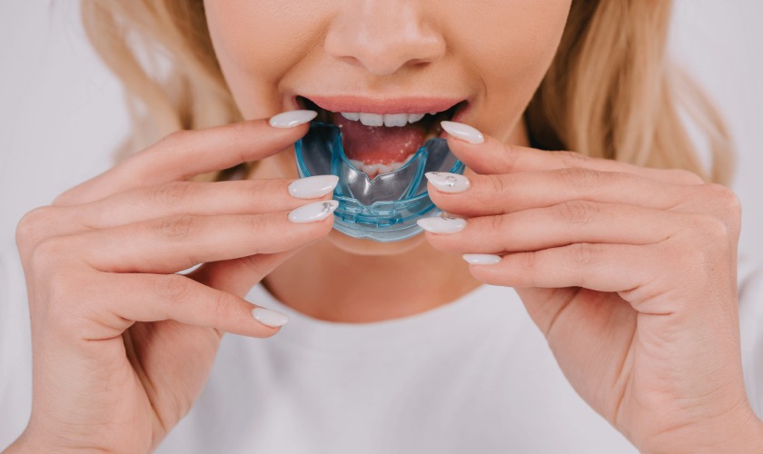 Niềng răng silicon không có tác dụng quá lớn đối với người lớn