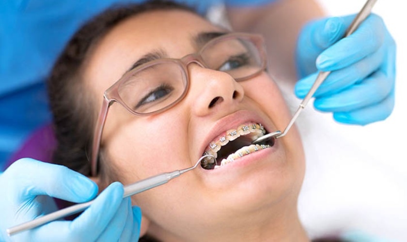 Niềng răng không đúng cách mang lại hậu quả nghiêm trọng