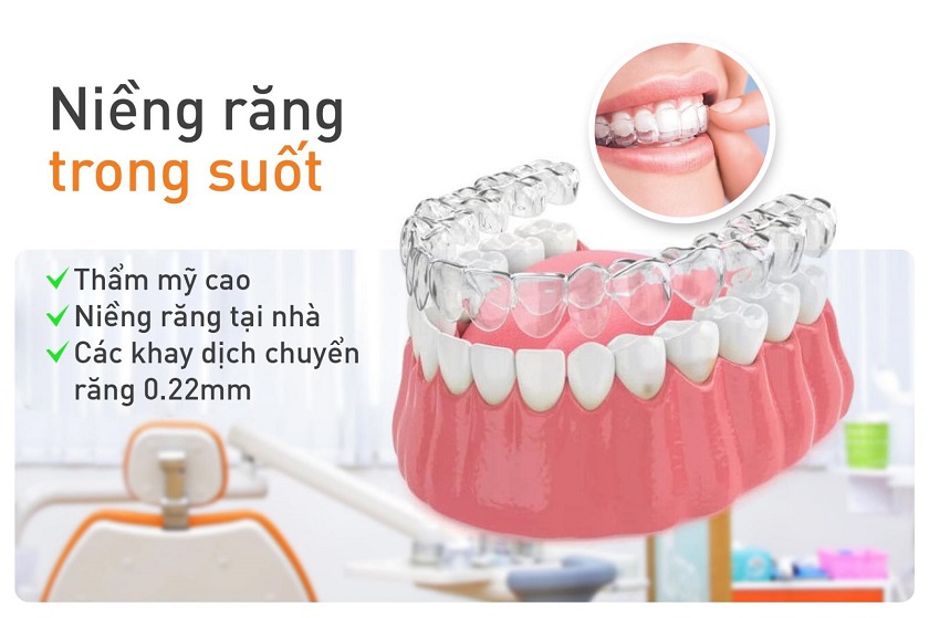 Ưu điểm của niềng răng trong suốt Invisalign