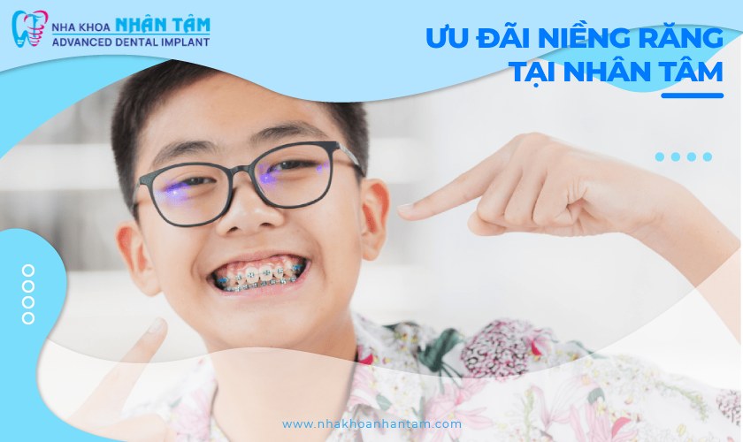 Hình: Chương trình ưu đãi niềng răng cho trẻ tại Nhân Tâm