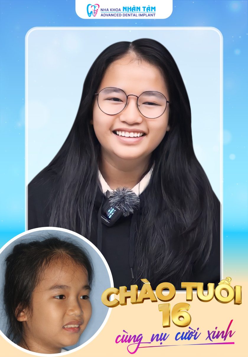 Niềng răng sớm cho trẻ mang lại nhiều lợi ích tuyệt vời