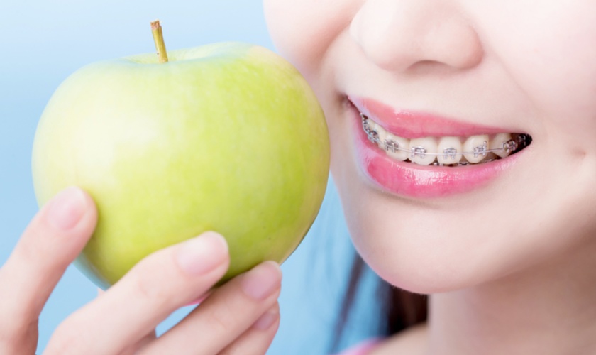 Cần xây dựng chế độ ăn uống trong khi niềng răng