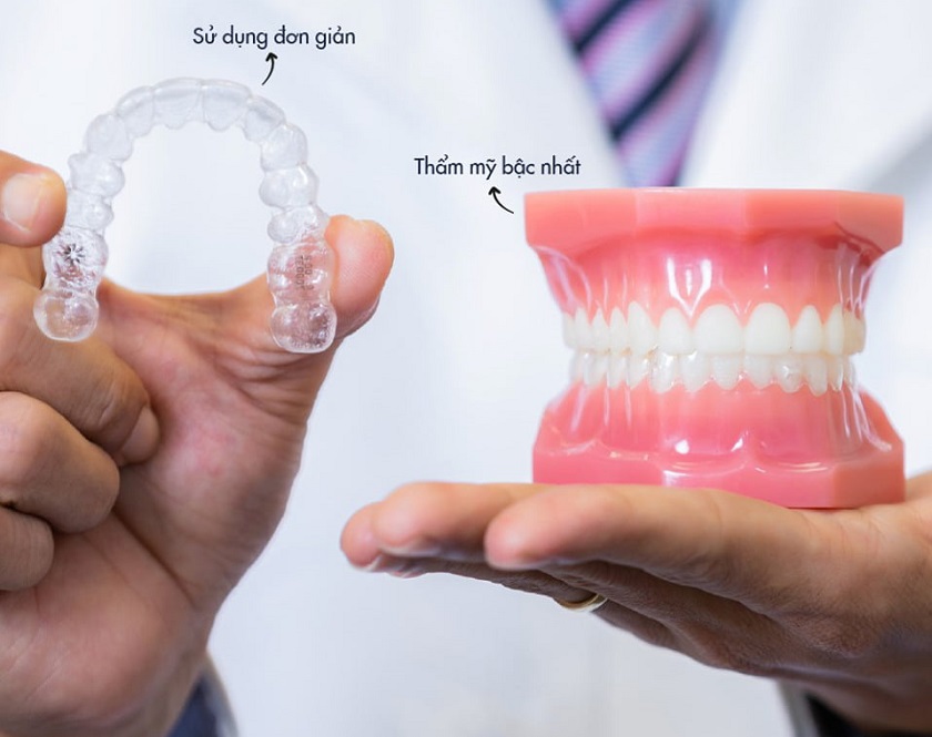 Niềng răng trong suốt tiện dụng và có tính thẩm mỹ cao