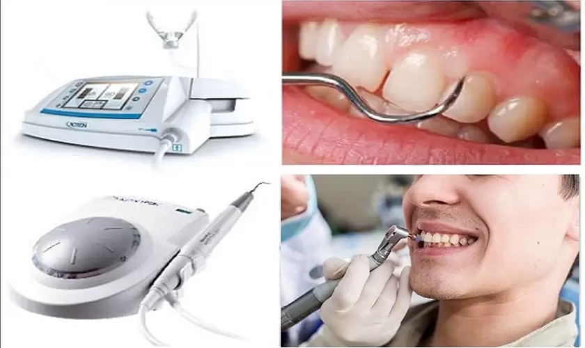 Lấy cao răng bằng công nghệ siêu âm hiện đại