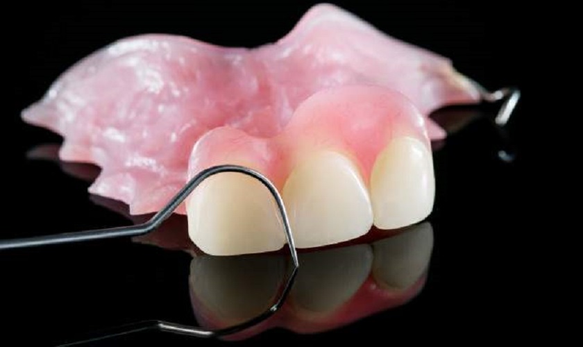 Răng giả tháo lắp bao nhiêu tiền?