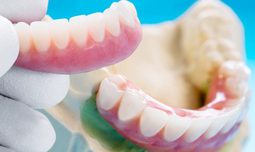 Cần tháo răng giả để vệ sinh sạch sẽ