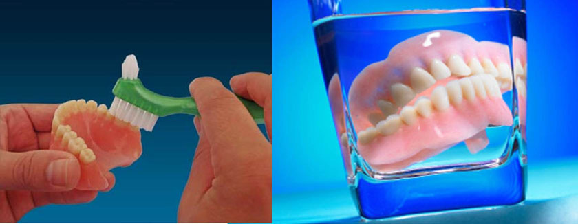 Hàm giả tháo lắp dễ dàng để vệ sinh