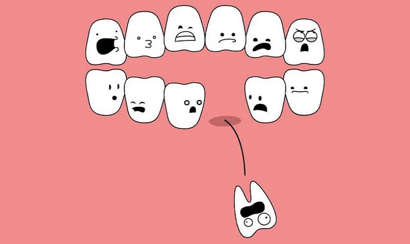Thời gian chữa trị răng gãy mất bao lâu?

