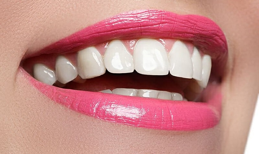 Răng sứ 800k có phải là mức giá răng sứ rẻ nhất hiện nay?