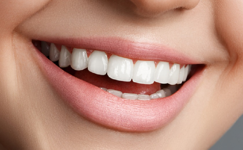 Tính thẩm mỹ vượt trội của răng sứ Emax