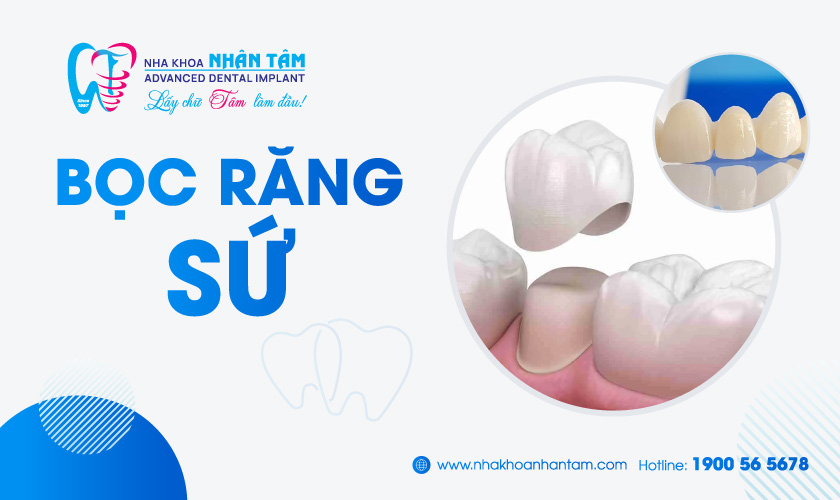 Giá làm răng sứ có cao không?