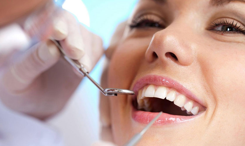 Răng toàn sứ giá bao nhiêu? Nên chọn bọc răng toàn sứ giá rẻ