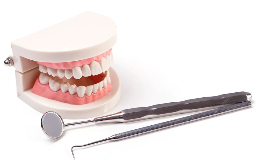 Răng sứ kim loại titan không được bóng như răng toàn sứ