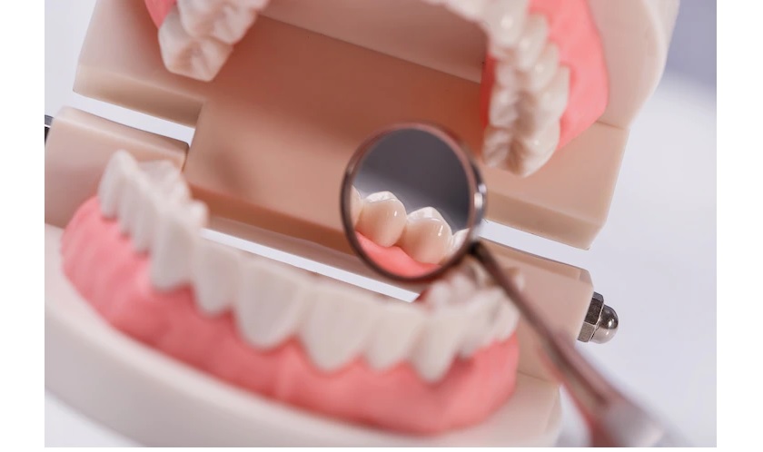 Răng sứ Zirconia hiện nay có 4 dòng phổ biến trên thị trường