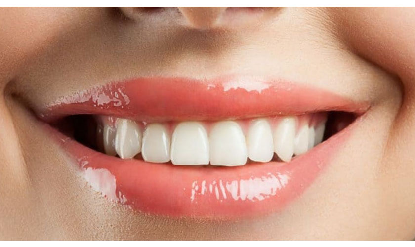 Cách khắc phục răng cửa to nhanh nhất hiện nay