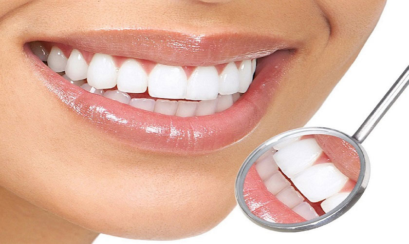 Răng sứ Titan có mấy loại? Dòng nào được ưa chuộng hiện nay?