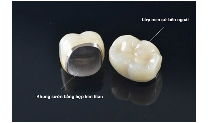 Trang thiết bị hiện đại tại Nha khoa Nhân Tâm