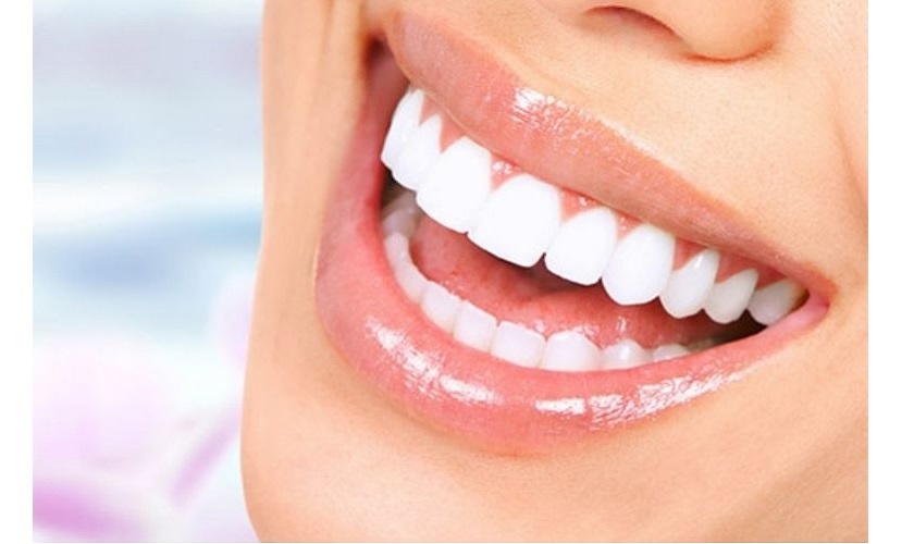 Trồng răng sứ giá bao nhiêu 1 chiếc? Cập nhật mới nhất