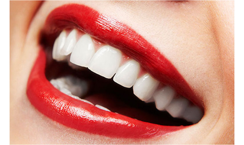 Bọc răng sứ thẩm mỹ có ảnh hưởng đến sức khỏe không?