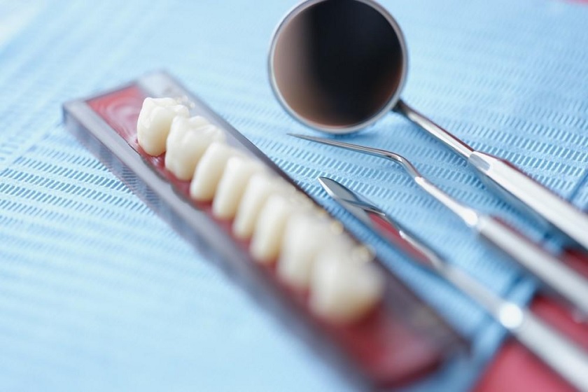 Bọc răng sứ thẩm mỹ là phương pháp phù hợp cho những trường hợp răng không thể tẩy trắng