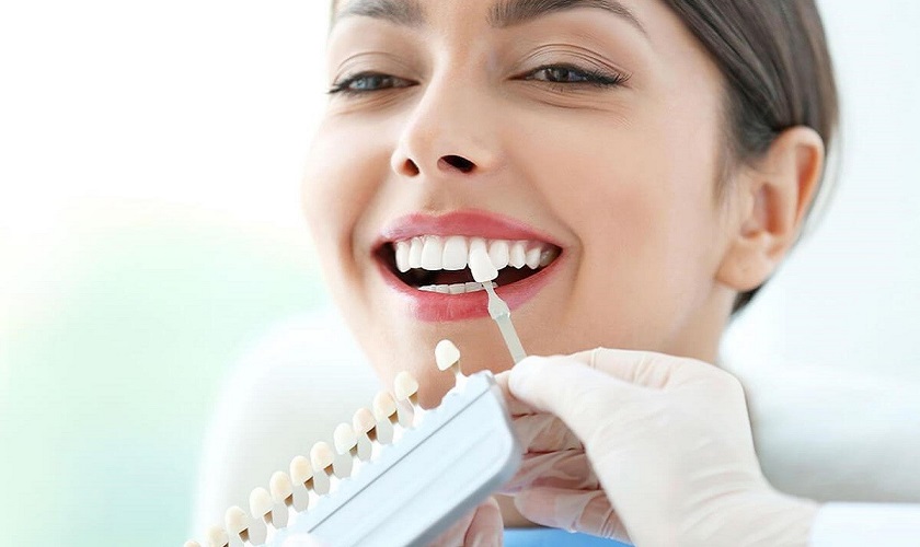 Răng sứ Cercon và Emax: Ưu nhược điểm và điều khác biệt