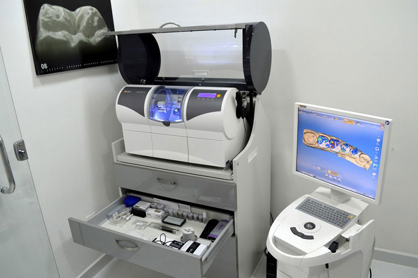 Công nghệ CAD/CAM giúp hoàn thành răng sứ một cách nhanh chóng