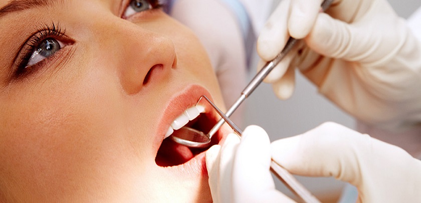 Bọc răng sứ thẩm mỹ