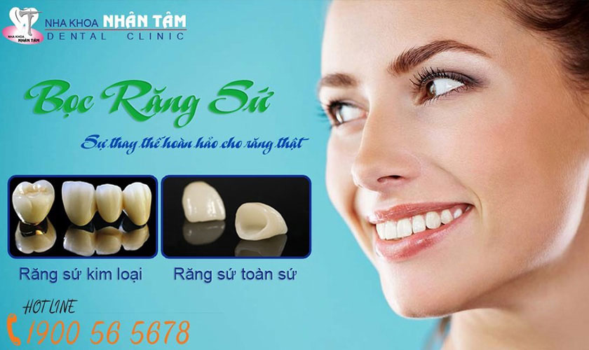 Bọc răng sứ là gì? Trường hợp nên và không nên bọc răng sứ