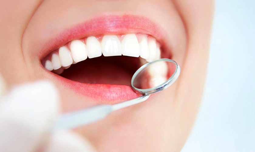 Cập nhật giá bọc răng sứ mới nhất hiện nay