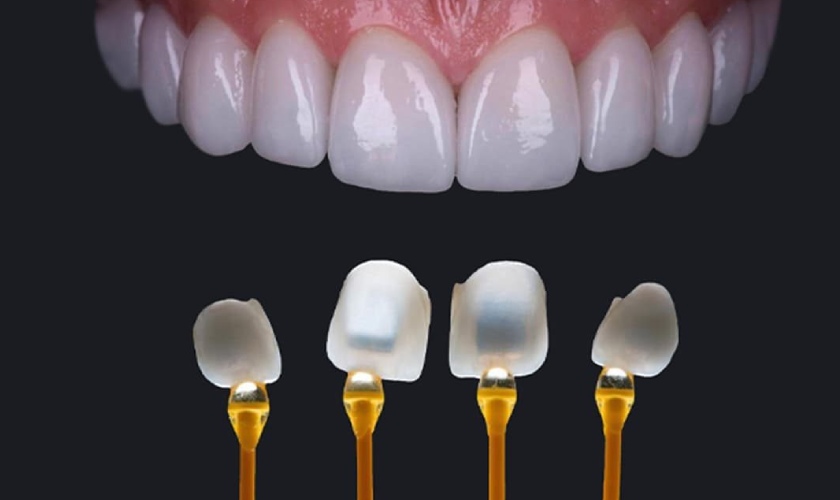 Chất lượng sứ càng tốt chi phí sẽ càng cao