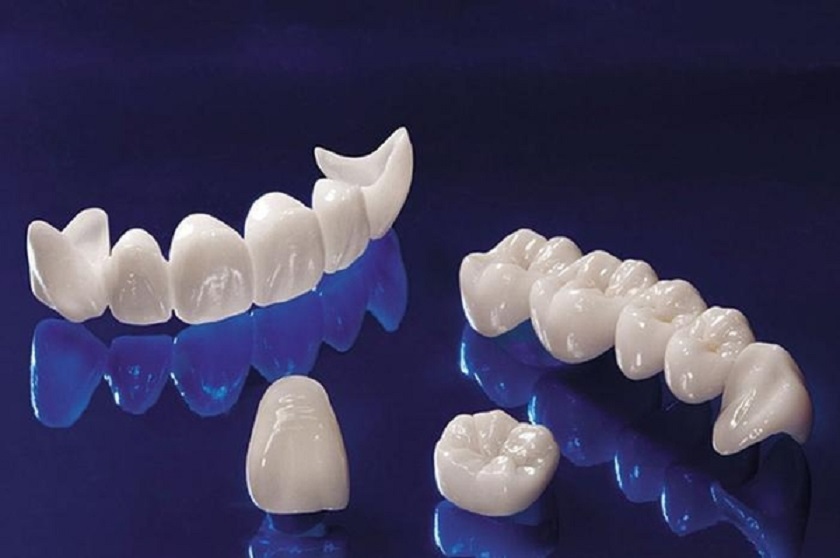 Giá răng sứ Zirconia hiện nay
