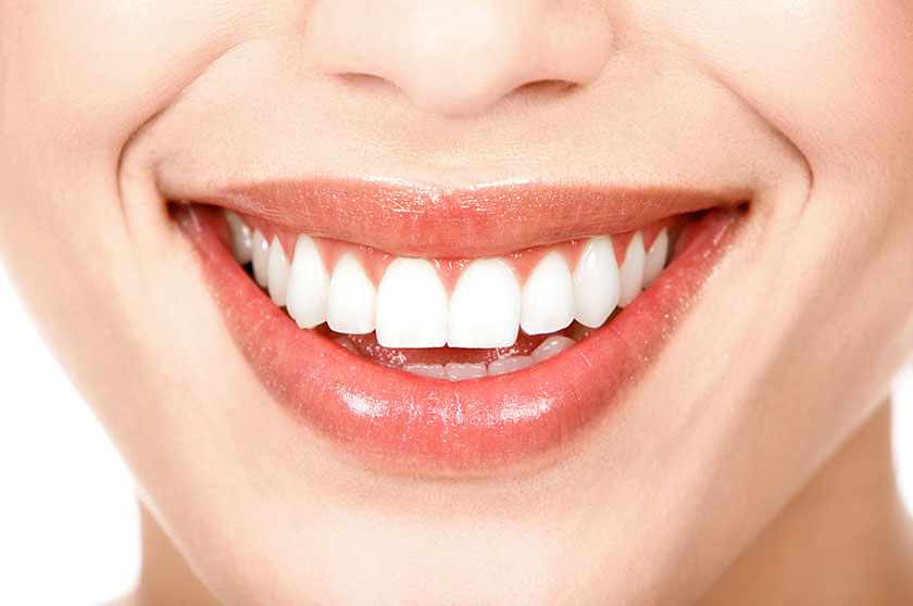 Bọc răng sứ thẩm mỹ được xem là một cách hiệu quả để khắc phục những khiếm khuyết của răng