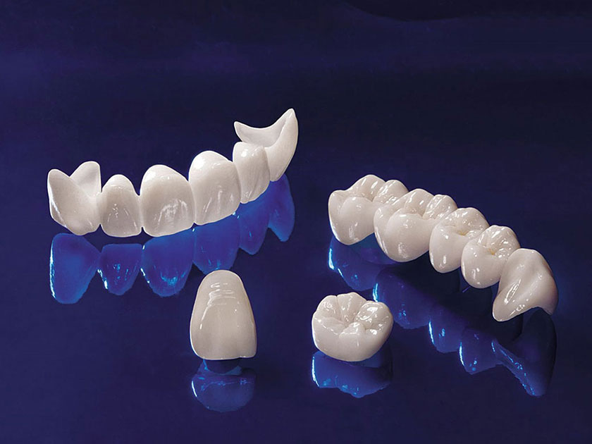 Răng toàn sứ Cercon là giải pháp phục hình thẩm mỹ cho răng được nhiều khách hàng lựa chọn